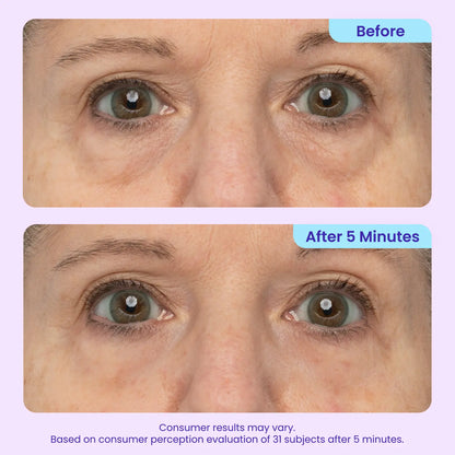Insideefy Lift Eye Gel – Hydrating & Refreshing Under-Eye Care
