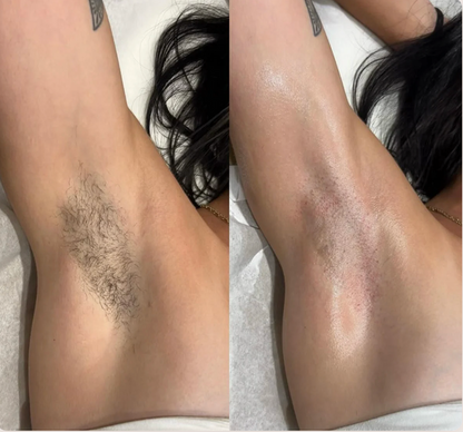 Bikini Pain-Free Hair Removal Cream for Sensitive Skin